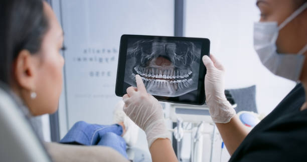 Licensed Tooth Extraction service in Massillon, OH - Smile Center Dentistry